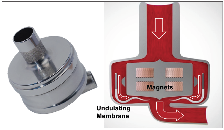The Next Wave of Mechanical Circulatory Support Devices - Cardiac ...