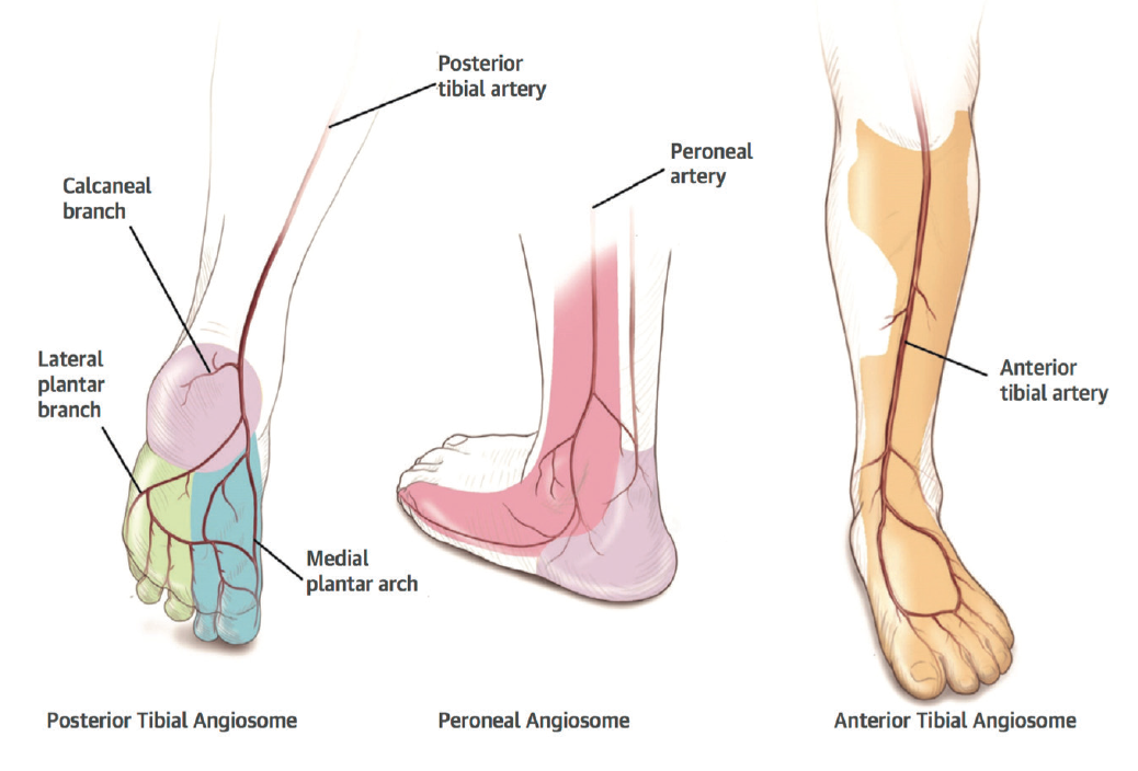 peroneal artery foot