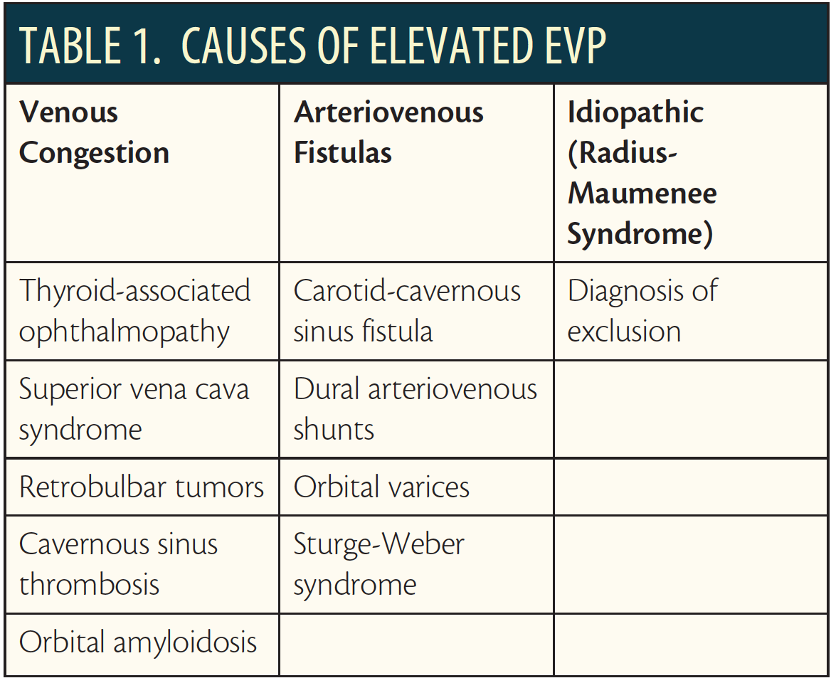 Increased Episcleral Venous Pressure as an Etiology of Glaucoma