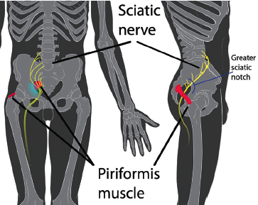 inferior gluteal nerve injury